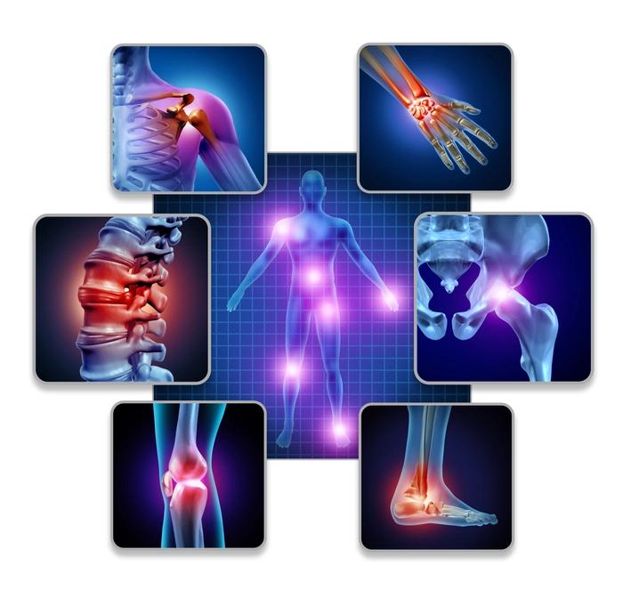 Arthritis - Joint Pain Worst at Night or Early Morning